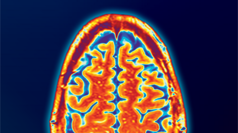 Colourful visualization of a brain scan
